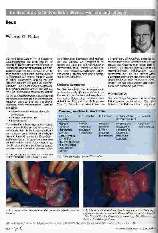 Vorschauseite 1: Ileus