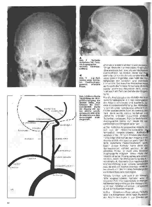 Vorschauseite 3: Themen aus der Neurochirurgie 2. Folge: Neuroradiologische Diagnostik