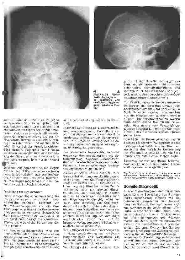 Vorschauseite 4: Themen aus der Neurochirurgie 2. Folge: Neuroradiologische Diagnostik
