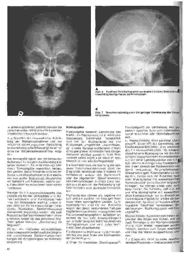 Vorschauseite 5: Themen aus der Neurochirurgie 2. Folge: Neuroradiologische Diagnostik