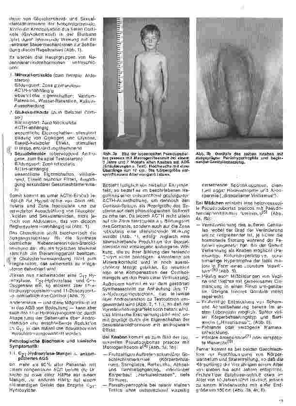 Vorschauseite 2: Kinderheilkunde Vererbte Krankheiten 10. Folge: Das Adreno-genitale Syndrom