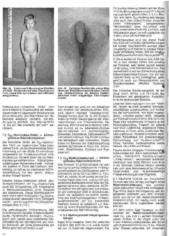 Vorschauseite 3: Kinderheilkunde Vererbte Krankheiten 10. Folge: Das Adreno-genitale Syndrom