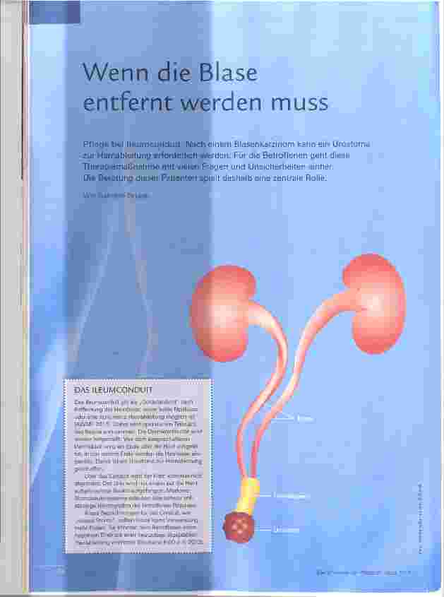 Vorschauseite 1: Wenn die Blase entfernt werden muss