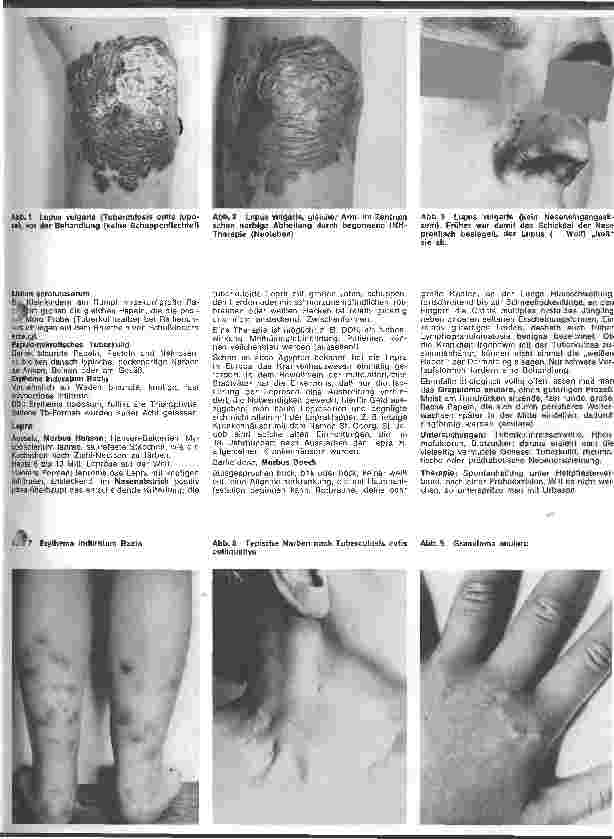 Vorschauseite 2: Der hautkranke Patient 10.Folge: Spezielle Dermatologie: Erregerbedingte Hauterkrankungen III. Bakterien (Fortsetzung)