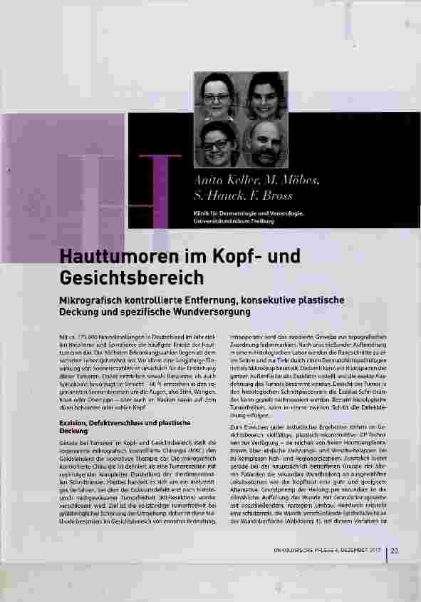 Vorschauseite 1: Hauttumoren im Kopfund Gesichtsbereich