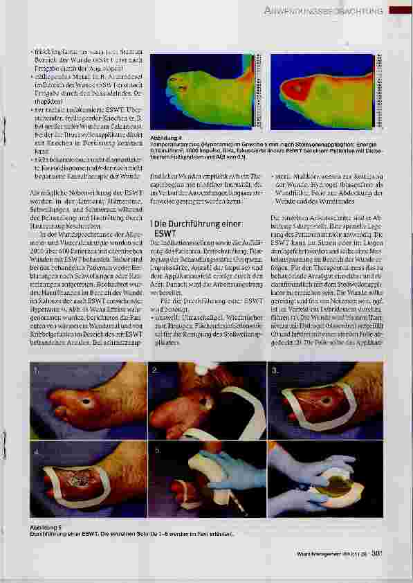 Vorschauseite 4: Die extrakorporale Stoßwellentherapie in der Behandlung chronischer Wunden in der Wundsprechstunde Ein Erfahrungsbericht