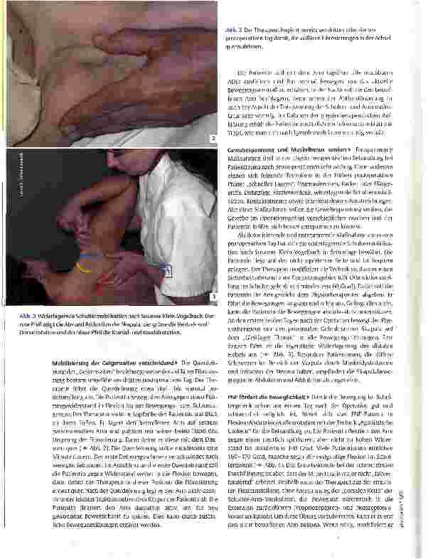 Vorschauseite 3: Mobilisation der Fibrosierung beim Mammakarzinom Die Geigensaiten querdehnen