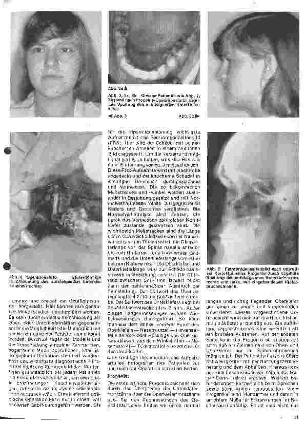 Vorschauseite 2: Zahn-, Mundund Kieferchirurgie 12. Folge (Schluß): Kieferorthopädische Chirurgie