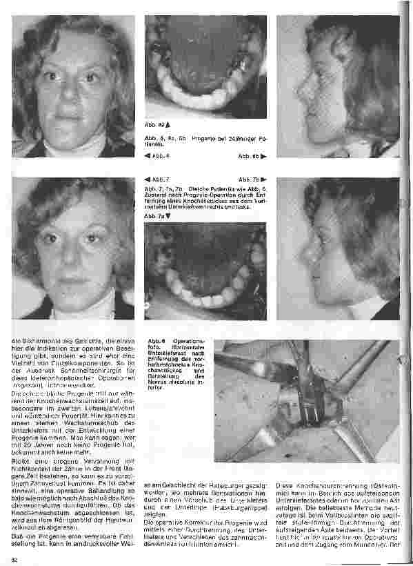 Vorschauseite 3: Zahn-, Mundund Kieferchirurgie 12. Folge (Schluß): Kieferorthopädische Chirurgie