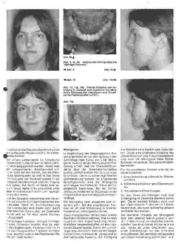 Vorschauseite 4: Zahn-, Mundund Kieferchirurgie 12. Folge (Schluß): Kieferorthopädische Chirurgie