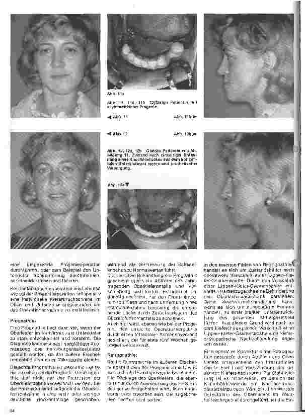 Vorschauseite 5: Zahn-, Mundund Kieferchirurgie 12. Folge (Schluß): Kieferorthopädische Chirurgie