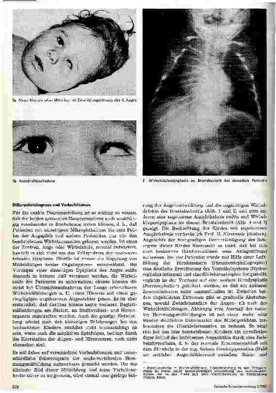 Vorschauseite 2: Zur Klinik und Pathologie des oculo-vertebralen Syndroms