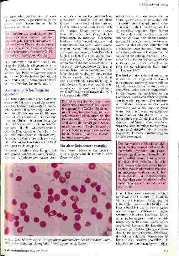 Vorschauseite 4: Coli und Kinder