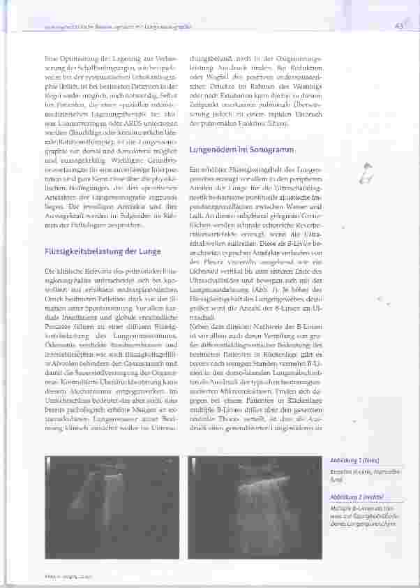 Vorschauseite 2: Intensivmedizinische Beatmungsvisite mit Lungensonographie