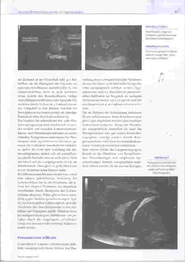 Vorschauseite 4: Intensivmedizinische Beatmungsvisite mit Lungensonographie