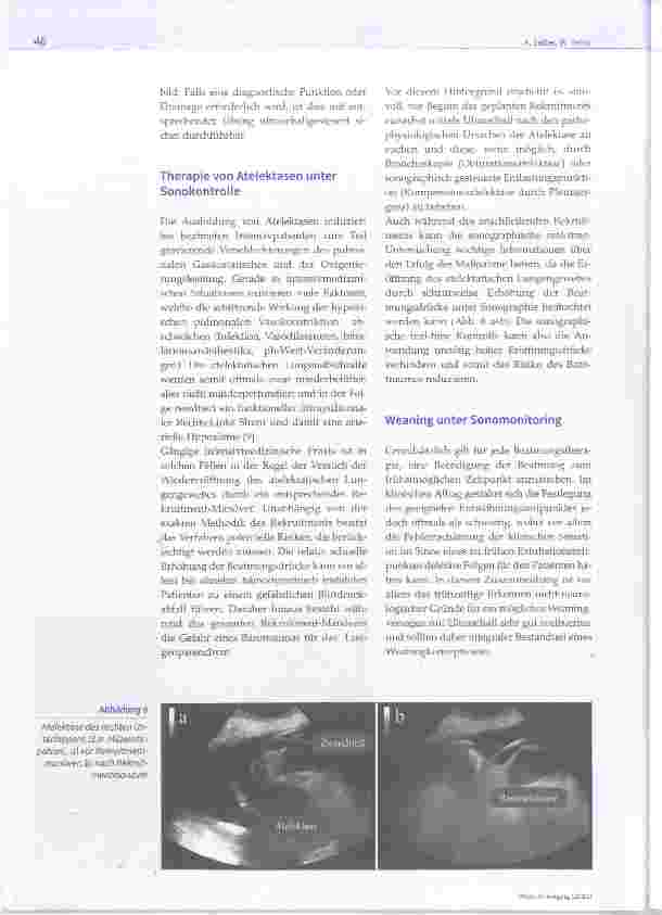 Vorschauseite 5: Intensivmedizinische Beatmungsvisite mit Lungensonographie