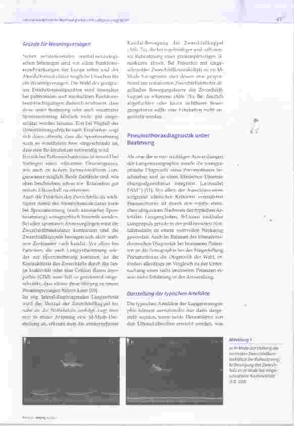 Vorschauseite 6: Intensivmedizinische Beatmungsvisite mit Lungensonographie