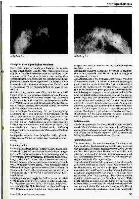 Vorschauseite 4: Früherkennung von Brustkrebs