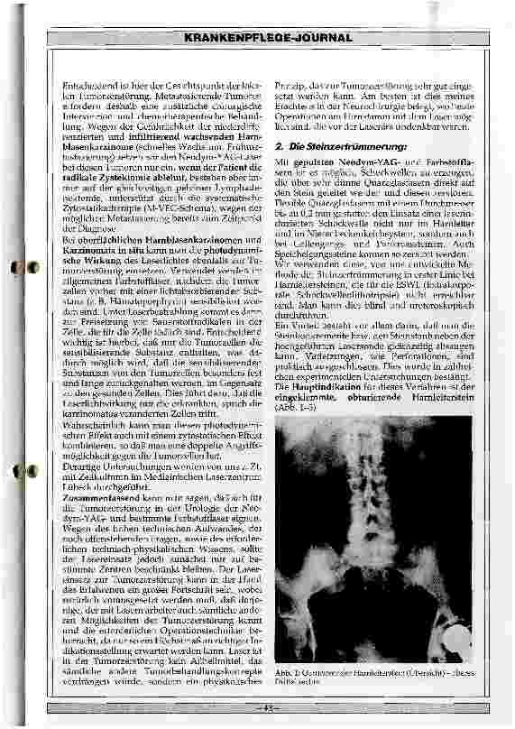 Vorschauseite 2: Einsatzmöglichkeiten des Lasers in der Urologie