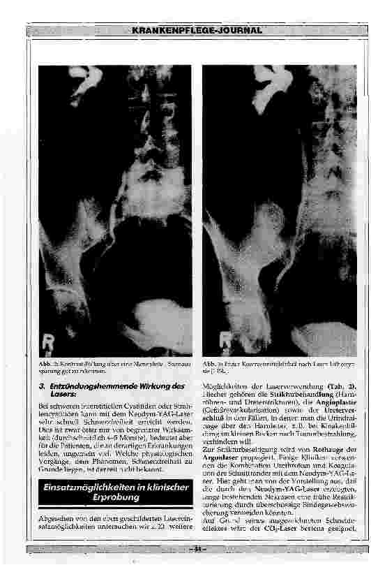 Vorschauseite 3: Einsatzmöglichkeiten des Lasers in der Urologie