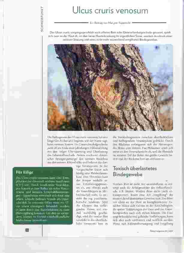 Vorschauseite 1: Ulcus cruris venosum