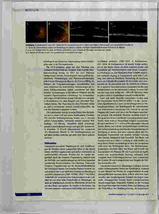 Vorschauseite 4: Netzhautschädigung durch Laserpointer-Exposition