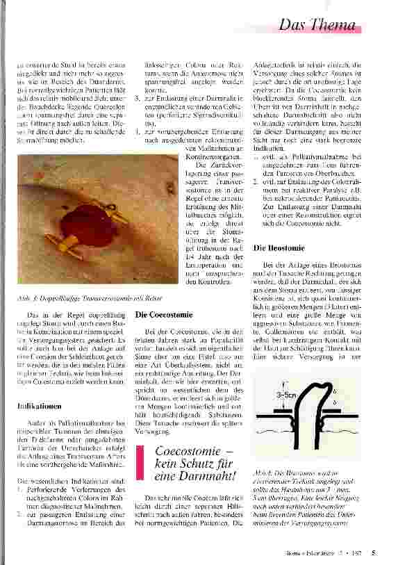Vorschauseite 3: Engagiert und prominent Stomachirurgie - Indikationen und Anlagetechniken