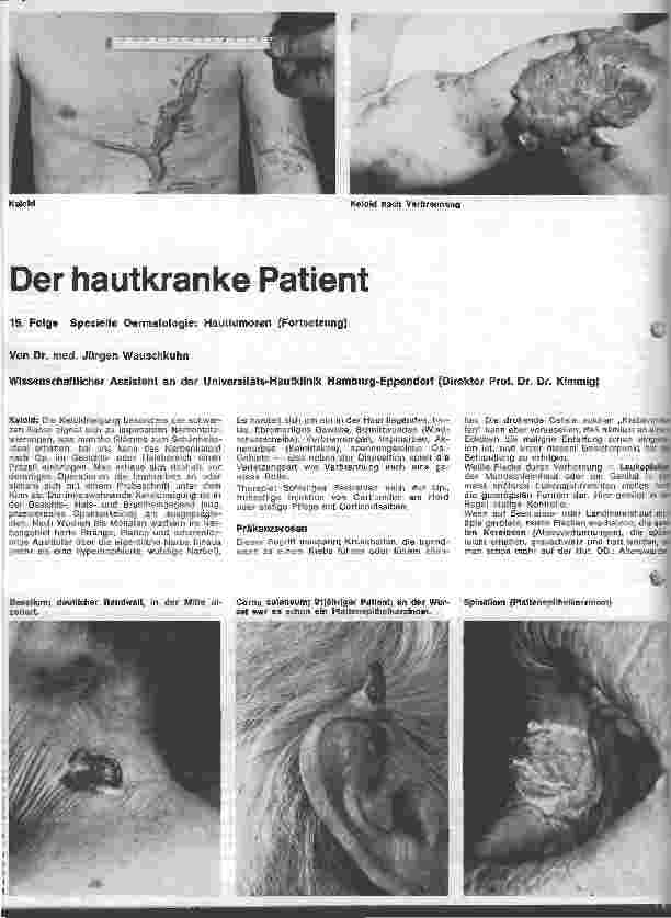 Vorschauseite 1: Der hautkranke Patient 15. Folge: Spezielle Dermatologie: Hauttumore (Fortsetzung)