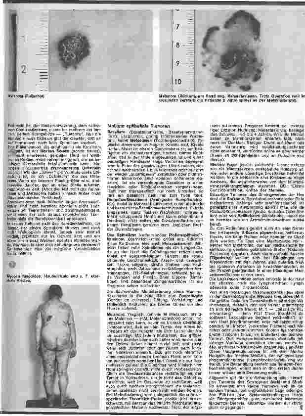 Vorschauseite 2: Der hautkranke Patient 15. Folge: Spezielle Dermatologie: Hauttumore (Fortsetzung)