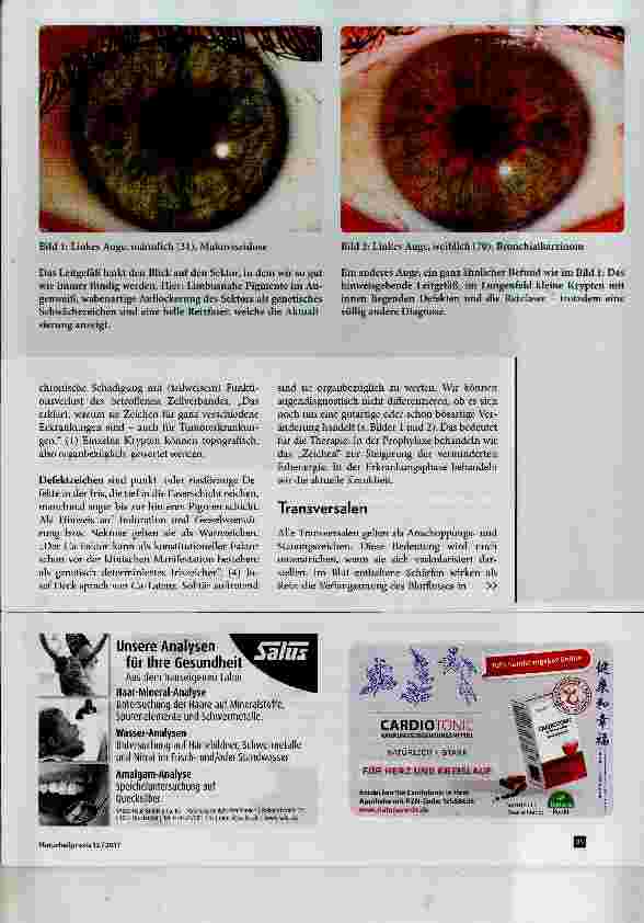 Vorschauseite 3: Augendiagnose und Krebs wie geht das?
