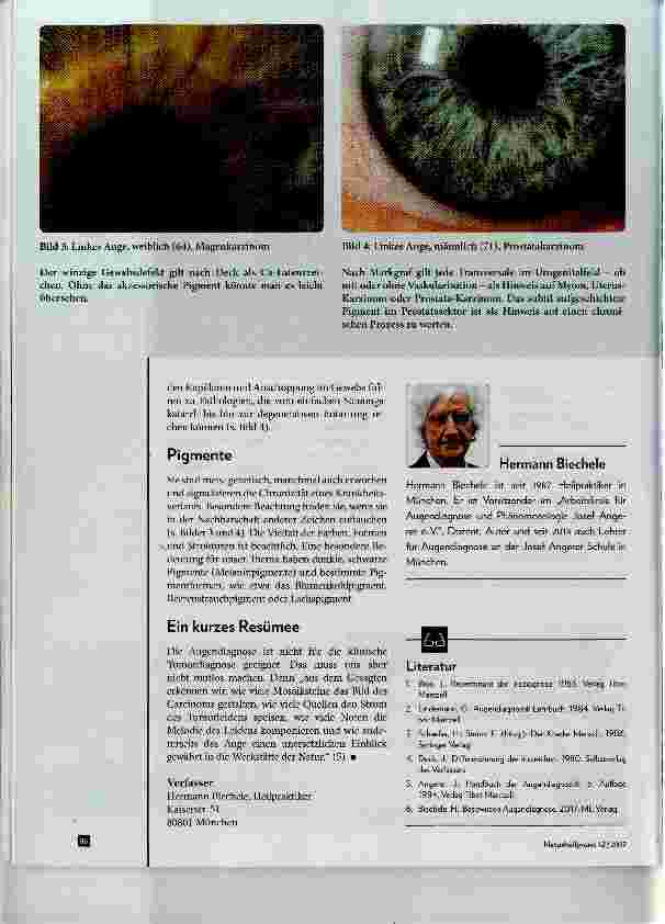 Vorschauseite 4: Augendiagnose und Krebs wie geht das?