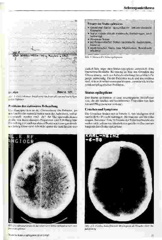 Vorschauseite 3: Anfallsserien und Status epilepticus Diagnose - Therapie - Differentialdiagnose - Probleme