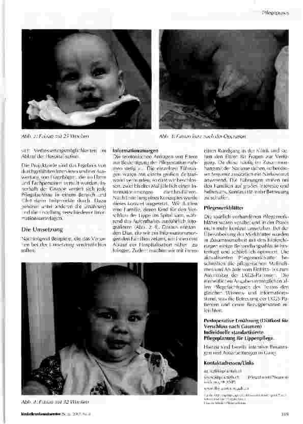 Vorschauseite 2: Familienorientierte Pflege von Kindern mit Lippen-Kiefer-Gaumenspalten