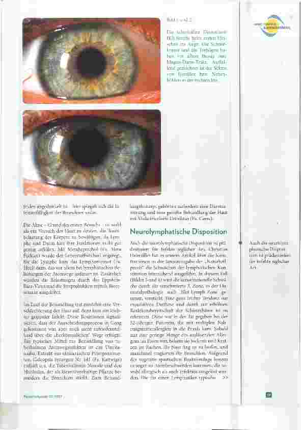 Vorschauseite 2: Sieht man das Ohr im Auge? Augendiagnose bei HNO-Erkrankungen