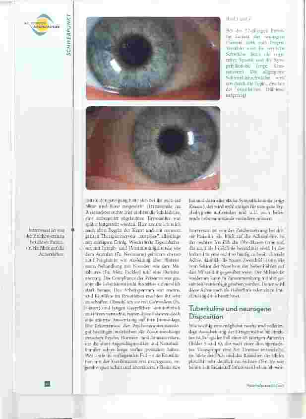 Vorschauseite 3: Sieht man das Ohr im Auge? Augendiagnose bei HNO-Erkrankungen