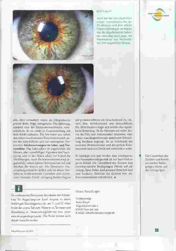Vorschauseite 4: Sieht man das Ohr im Auge? Augendiagnose bei HNO-Erkrankungen