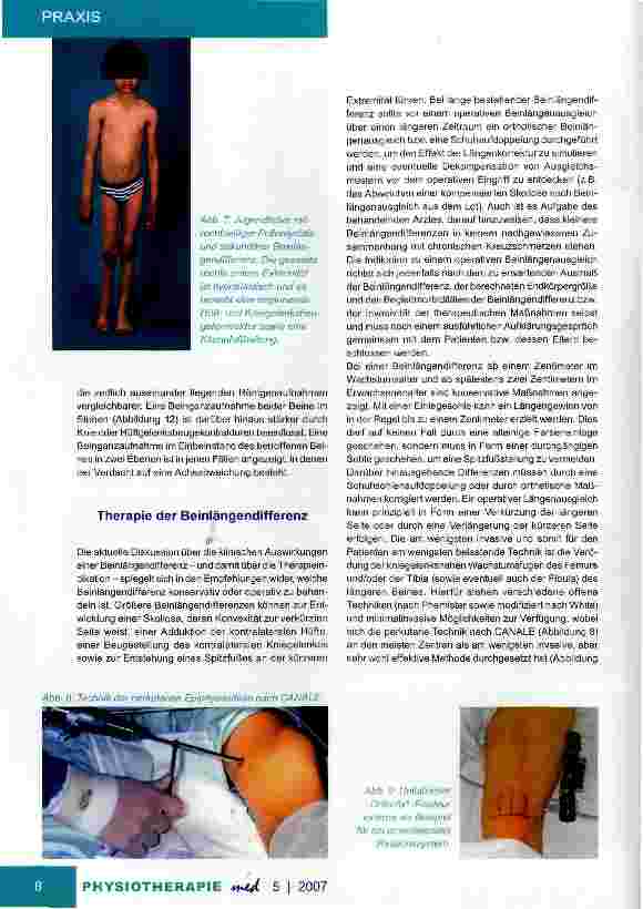 Vorschauseite 4: Beinlängendifferenzen Untersuchung und Therapie