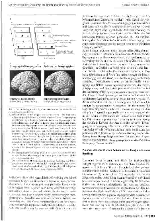 Vorschauseite 3: Von den neuronalen Grundlagen der Bewegungsplanung zu innovativen Therapiestrategien