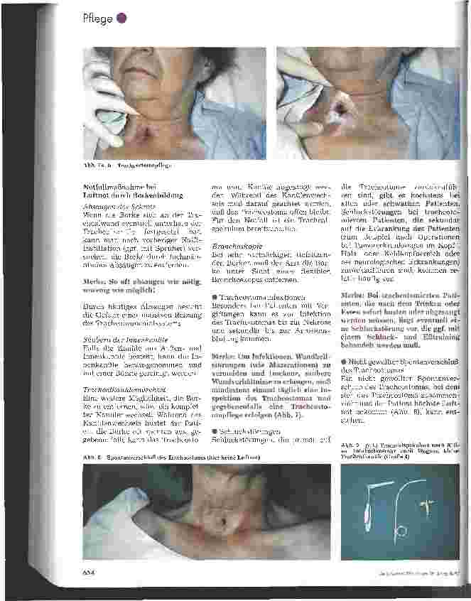 Vorschauseite 4: Komplikationen und Notfallsituationen bei tracheotomierten Patienten