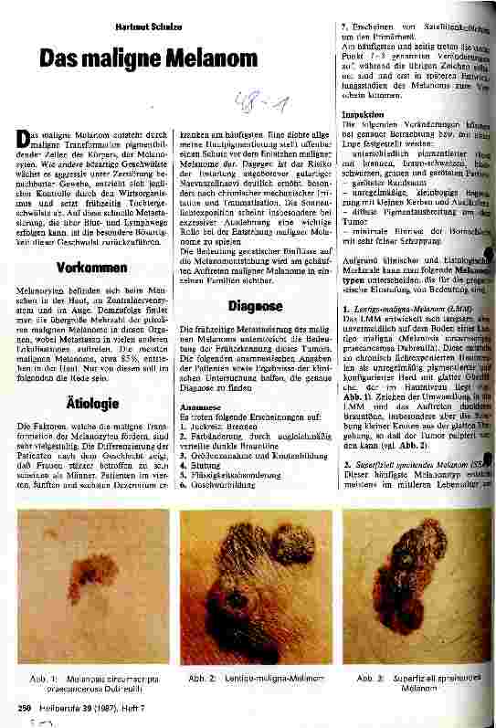 Vorschauseite 1: Das maligne Melanom