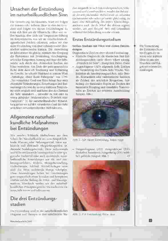 Vorschauseite 2: Naturheilkundliche Prinzipien bei entzündlichen Erkrankungen
