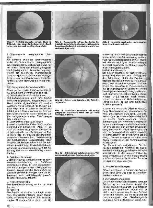 Vorschauseite 3: Einführung in die Augenheilkunde 10. Folge: Erkrankungen des Augenhintergrundes