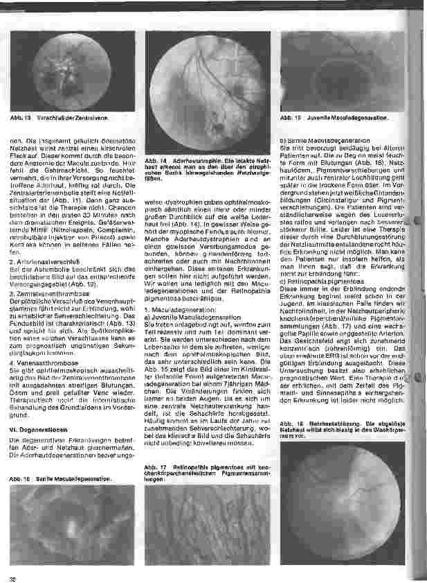 Vorschauseite 4: Einführung in die Augenheilkunde 10. Folge: Erkrankungen des Augenhintergrundes