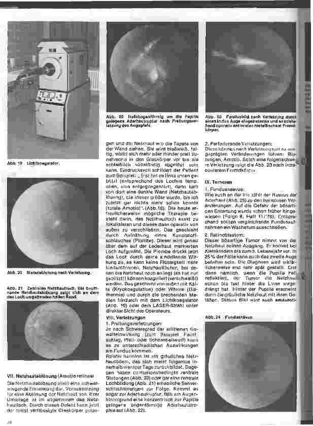 Vorschauseite 5: Einführung in die Augenheilkunde 10. Folge: Erkrankungen des Augenhintergrundes
