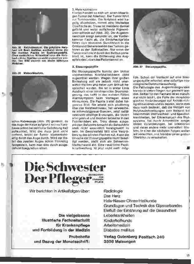 Vorschauseite 6: Einführung in die Augenheilkunde 10. Folge: Erkrankungen des Augenhintergrundes