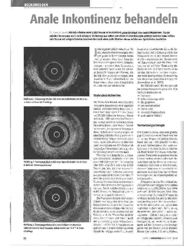 Vorschauseite 1: Anale Inkontinenz behandeln