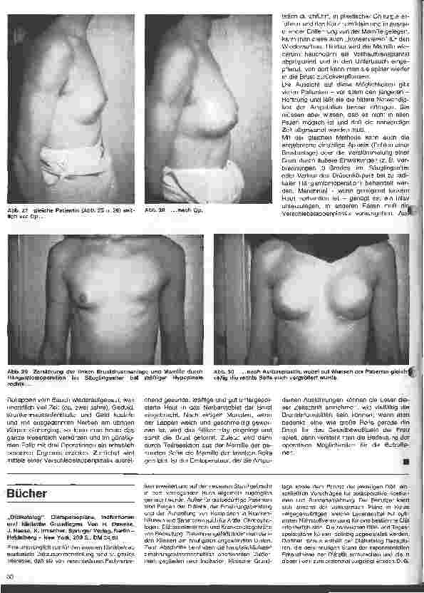 Vorschauseite 6: Die plastische Wiederherstellungschirurgie 5. Folge: Plastische und wiederherstellende Operationen der Brust