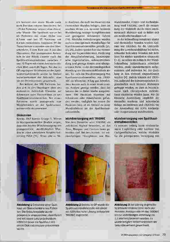 Vorschauseite 3: Postoperative Wundversorgung von Spalthautentnahmestellen mit Zink-Mangan-Kalzium Alginat-Wundauflagen: Ergebnisse einer retrospektiven klinischen Studie