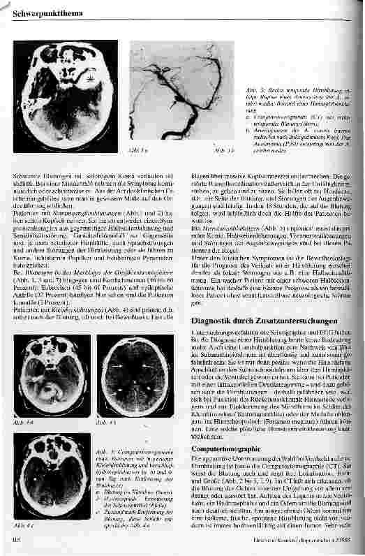 Vorschauseite 3: Spontane Hirnblutungen