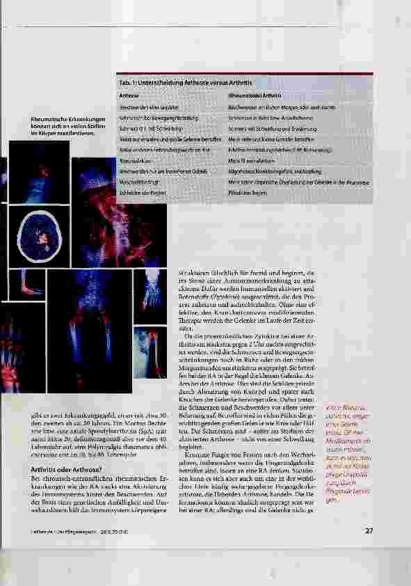 Vorschauseite 2: Rheumatische Erkrankungen unterscheiden lernen